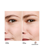 CC EYE