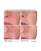 CENTELLA RED SERUM