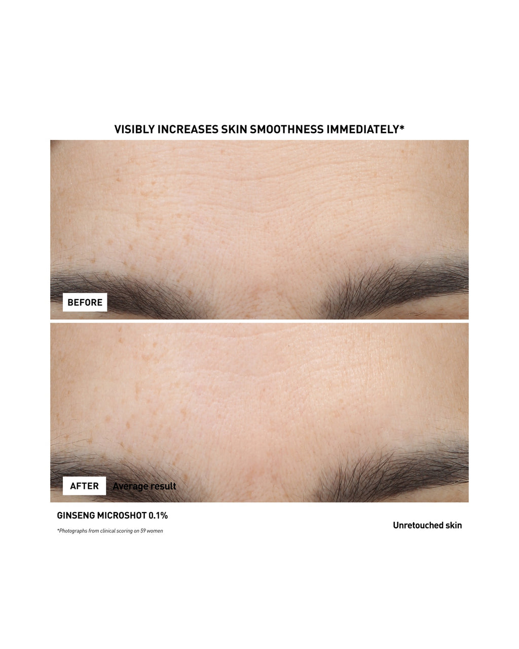 GINSENG MICRO SHOT 0.1%