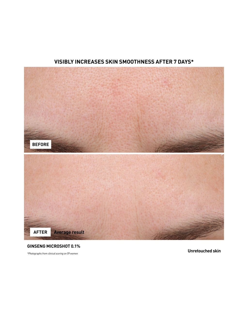 GINSENG MICRO SHOT 0.1%