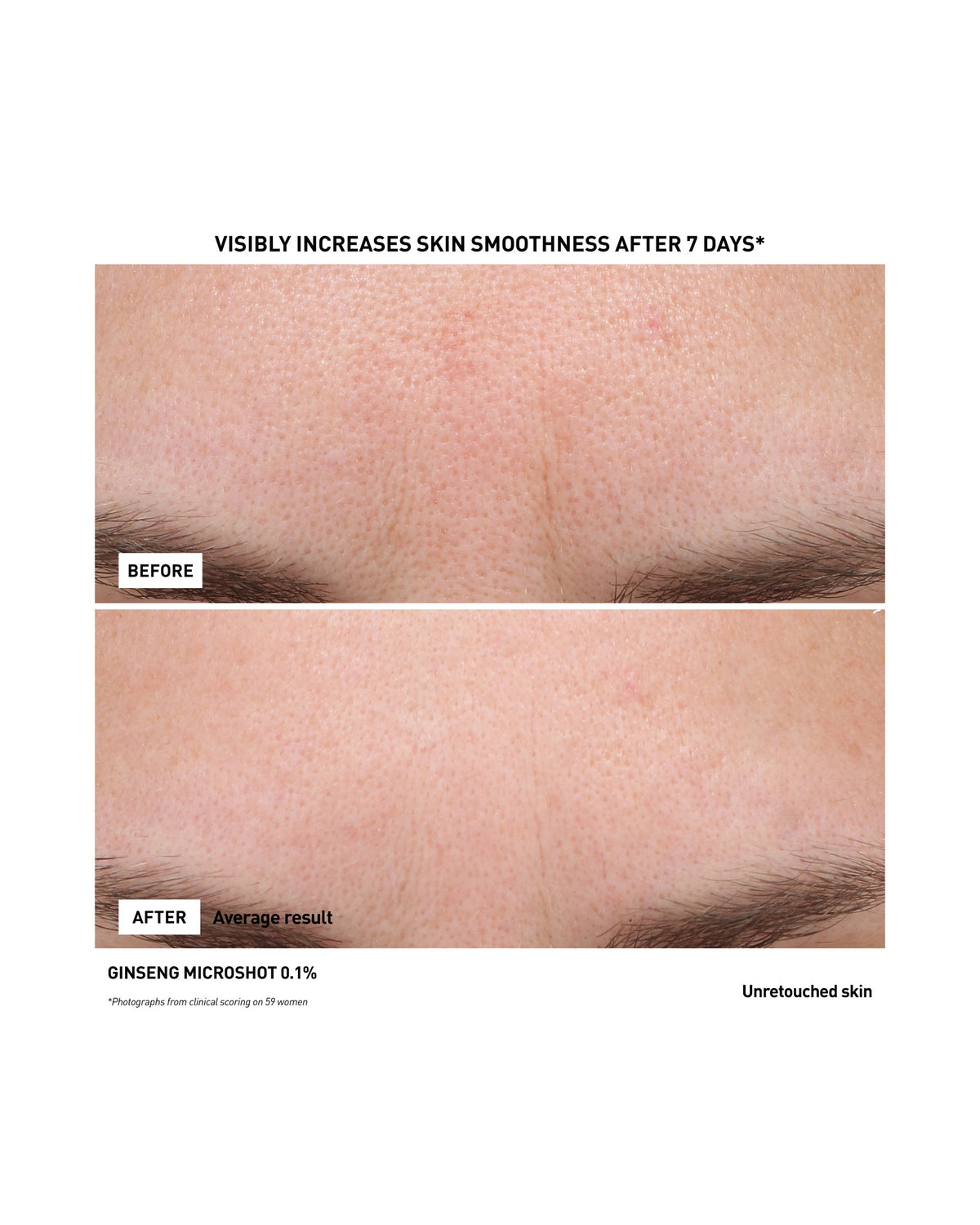 GINSENG MICRO SHOT 0.1%