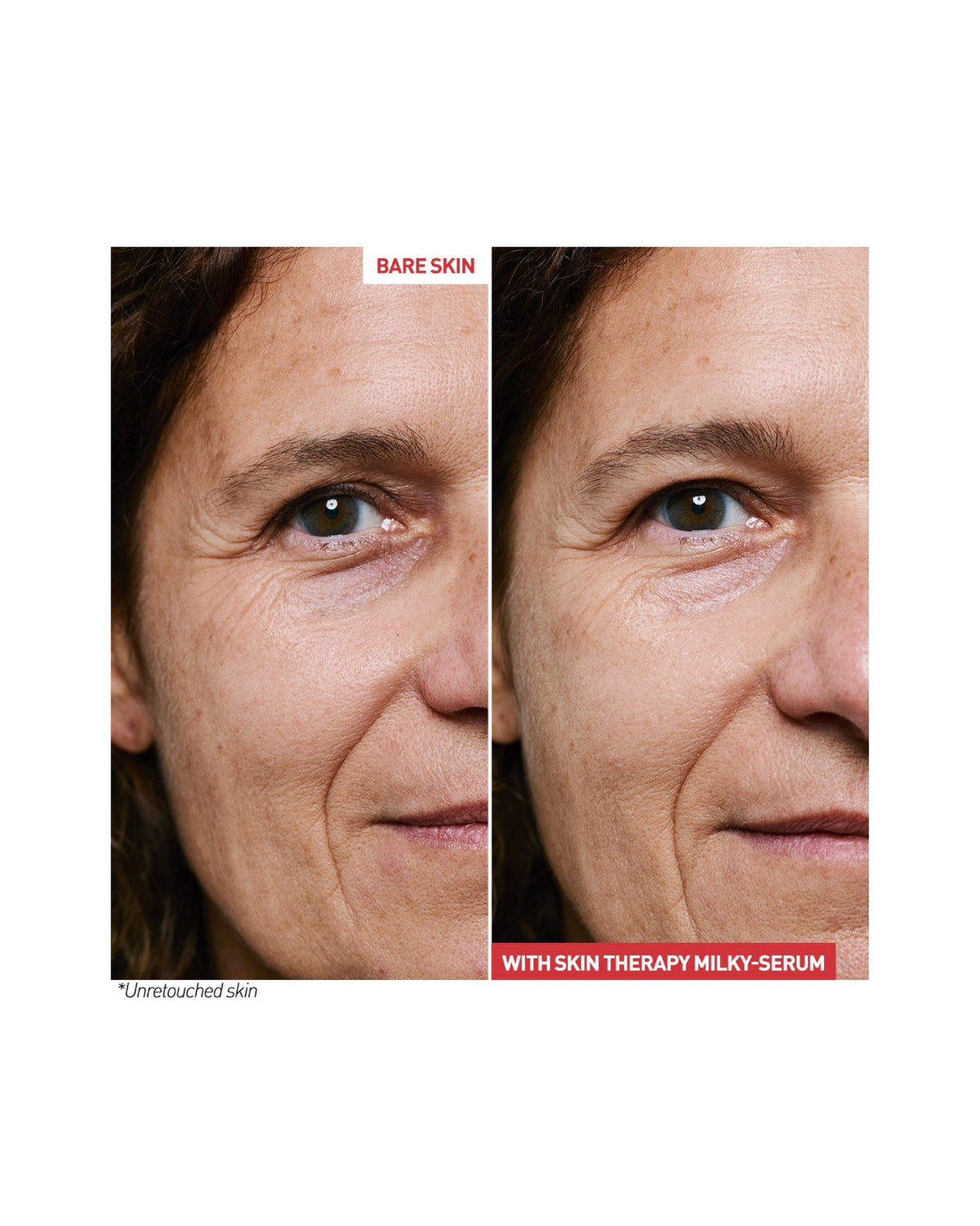 SKIN THERAPY MILKY-SERUM