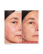SKIN THERAPY OIL-SERUM