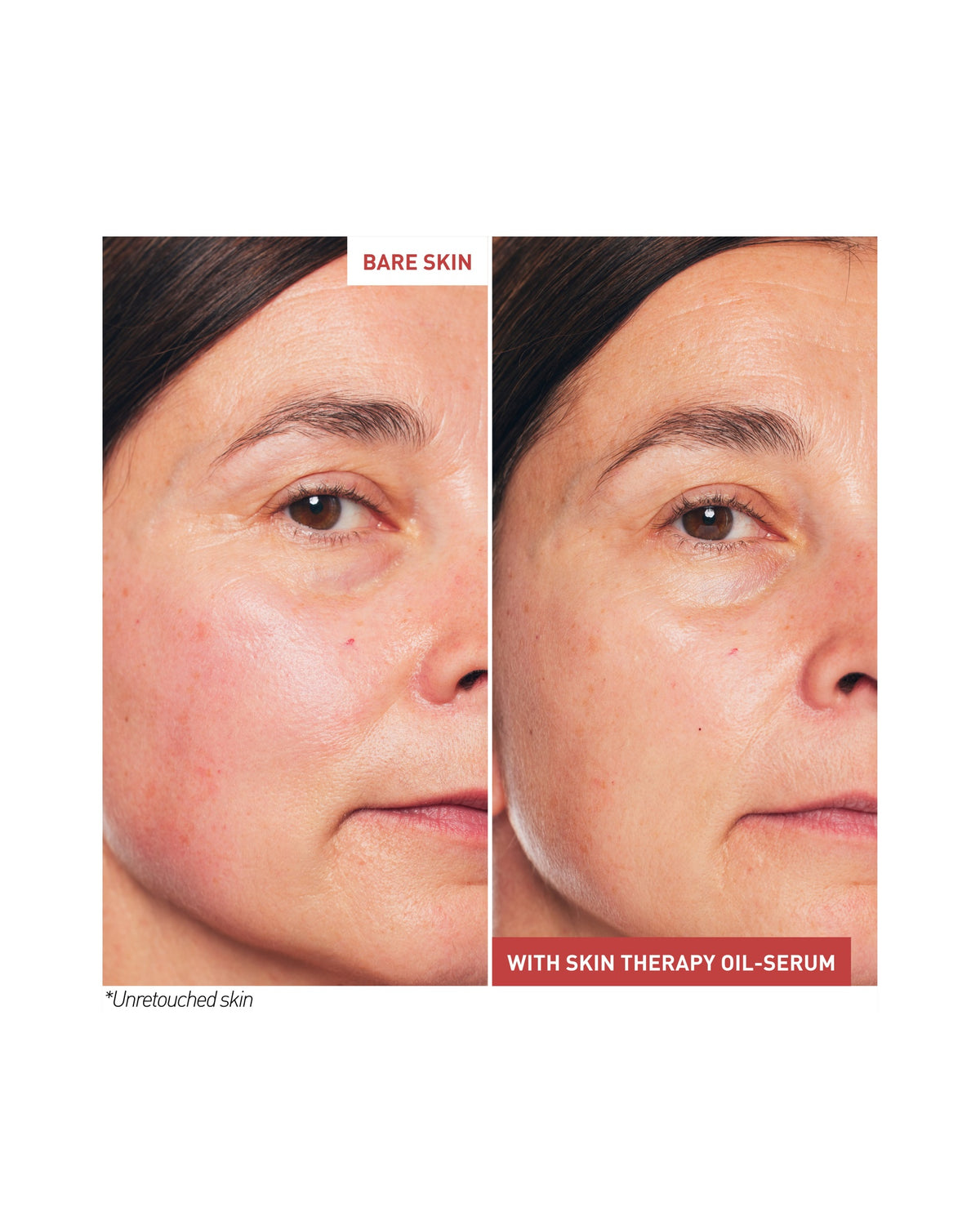 SKIN THERAPY OIL-SERUM